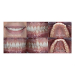 فلاش دنتال گودکس مخصوص سونی Godox MF12 Dental Macro Flash